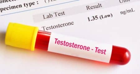 De ce este asociat nivelul redus de testosteron cu riscul de moarte prematură