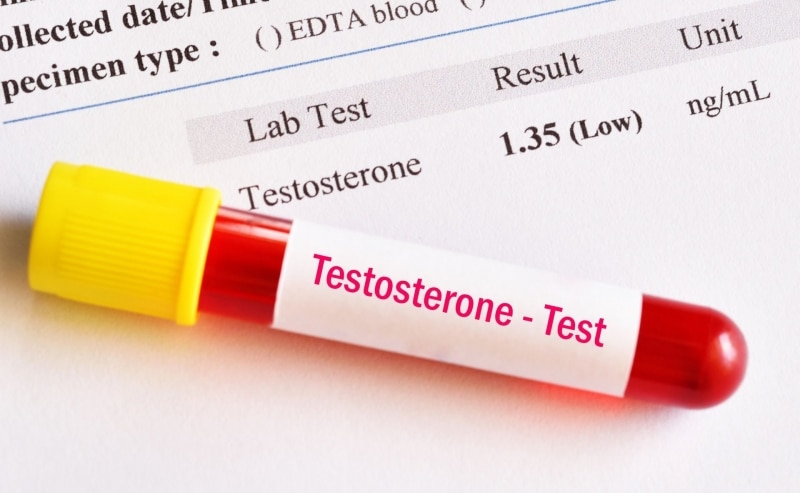 De ce este asociat nivelul redus de testosteron cu riscul de moarte prematură