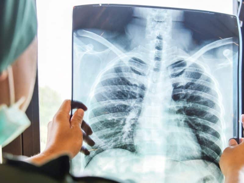 1.800 de radiologi deservesc şi mediul privat