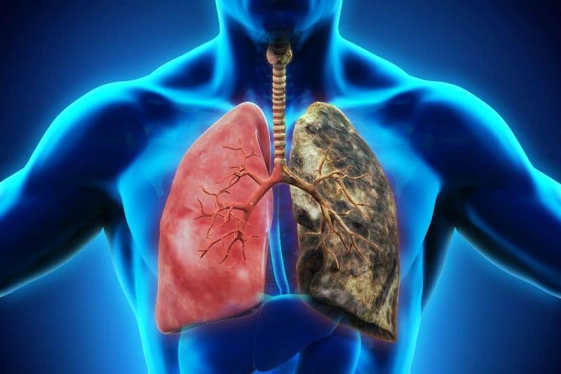 1,2 milioane de decese prin cancer pulmonar ar putea fi evitate