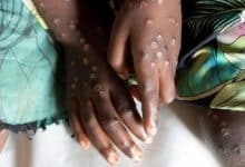 Noi cazuri de infecţie cu varianta mai periculoasă de mpox. Care sunt ţările care au confirmat îmbolnăviri