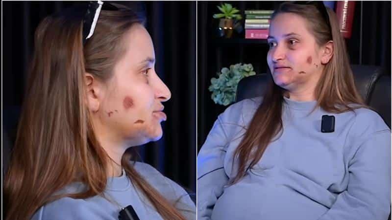 „Mi-a pus piciorul pe cap și cu degetele voia să-mi rupă gura”. O tânără însărcinată în luna a 9-a, bătută cu bestialitate de cumnatul său în ograda socrilor, la Anenii Noi